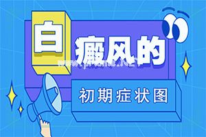 白风癫什么才可以治好[白癜风容易治疗吗]白癫疯手上能治愈吗