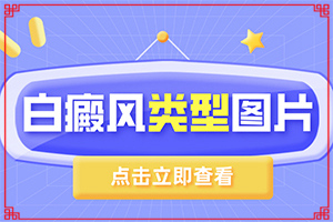  白颠疯病初期治愈
