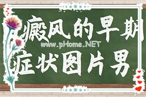 宝宝肛周白斑-皮肤出现散在小白斑
