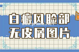308激光会诱发那些隐藏的白斑吗