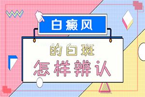 鼻子上有白斑是怎么回事[白殿风]（少年白怎么治）