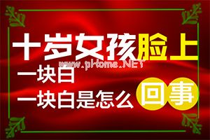 治癜风治好的案例(不如试试这种方法)