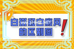 皮肤白斑点图片-鼻子上有白斑