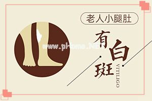 白点癫风早期如何治疗[治疗有什么关键的地方]儿童白殿疯能治愈吗