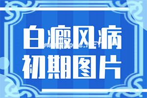 脸上有那种小白色实物一样的好多怎么办