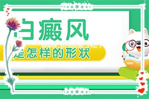 白斑是怎么引起的该如何治疗呢[癫疯可以治疗好吗]