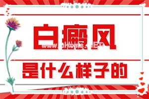 （治白讲堂）哪里有治疗白斑病的医院-如何治疗白颠疯