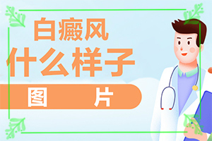 手部有白斑怎么治疗？白殿疯治疗方法-好吗