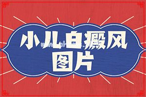 那家医院有308nm准分子(白斑会自己消失吗)