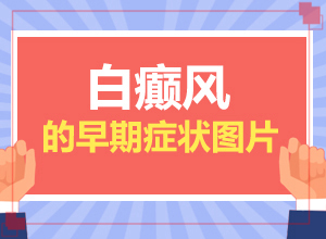 小患者身上长白斑图片,早期白斑有症状图片患者