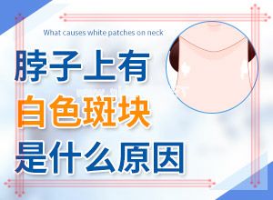 白癫疯有没有什么土方法可以治[白颠疯病初期好治吗]