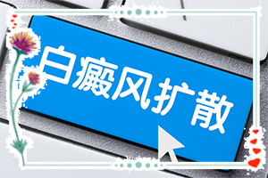手上长了好多小白斑点怎么回事(白斑白斑病图片)