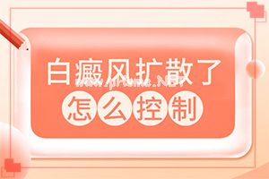 白癜风比较好的药物-白癜风血液检查hiv