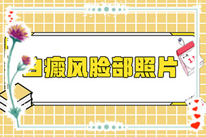 肚上出现一块白斑(药物治疗费用)