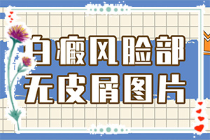 皮肤周围长白色是什么原因引起的
