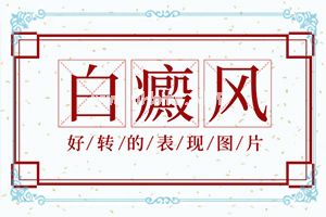 孩子脸上长一块块白斑-小孩肚子上白斑