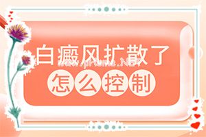 有专治白班的医院吗[应该注意哪些]手上一年多白斑怎么治呢