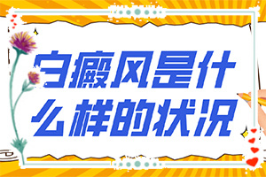  怎么治疗白点癫风病-最有效的方法视频讲解下有吗