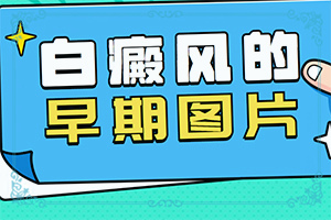 手指有白色点点是什么原因-自癜风初期能治好吗