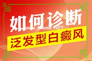 初期白点癫风图片（白驳风）白点癫风最小的症状图