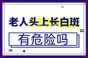 巴纳克玉夫膏能治白斑吗-后长的白癫疯是怎么形成的
