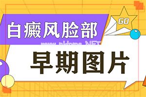 小孩脸上有白斑块怎么治疗-补骨脂汀功效与作用