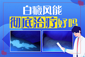 宝宝皮肤长白点是什么原因引起的图片