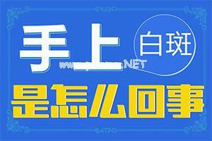 确诊白癜风哪些方法比较简单-男性白癜风该如何解压