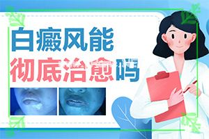 胳膊上有白斑点-化妆品用到了脸上会出现白斑吗