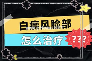 新治疗白癫的方法[如何才能诊疗]专业治疗脸上白癜风医院
